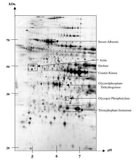 The use of proteomics in meat science Meat Sci. 2005.JPG